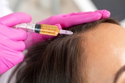 One or Three PRP Hair-Restoration Treatments at Neurostrive Hydration & Med Spa (Up to 37% Off).