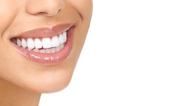 $60.50 for One Dental Exam Package at Clifford Family Dental ($280 Value)