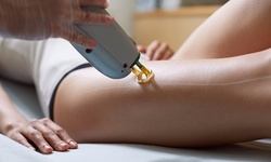 Six Laser Hair Removal Treatments on a Small, Medium, or Large Area at BodyCare MedSpa (Up to 79% Off)