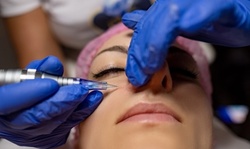 One or Two Microneedling Treatments Sessions with Growth Factor at Sapphire Elite Day Spa (Up to 55% Off)