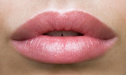 Up to 48% Off on Lip Enhancement at La-vie en rose