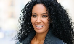 $31.50 for $1,800 toward Invisalign or Braces Treatment and Whitening Treatment or Take-Home Trays