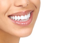 $196 Off Tooth Whitening (Regularly $475) at Winchester Family Dental