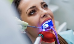 Up to 36% Off on Teeth Whitening - In-Office - Non-Branded at The Luxe Experience
