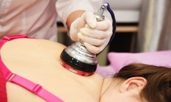 Up to 70% Off on Cavitation at Eyepolished