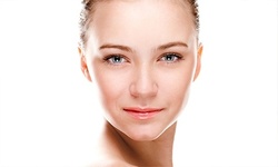 $356.50 for One Syringe of Restylane or an Equivalent Dermal Filler at Forever Young Skin Care ($750 Value)