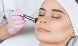 One 30-Minute Express Microdermabrasion Treatment at LUXE Aesthetics (Up to 48% Off)