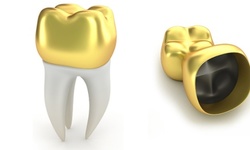 Up to 20% Off on Dental Filling at Todays Dental @ Alexandria