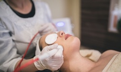 One or Three Radio-Frequency Skin-Tightening Treatments at Vanish Skin and Laser (Up to 57% Off)