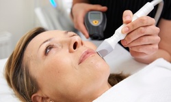 Six Sessions of Laser Hair-Removal on Small, Medium, or Large Area at I Am Jolie(Up to 80% Off)