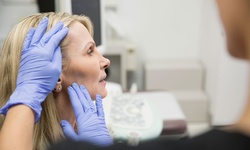 20 or 40 Units of Xeomin at Ann Webb Skin Clinic (Up to 24% Off)