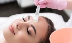 One, Three, or Five Dermaplaning Facials with Stem Cell Mask at The Well House at Lamson Mansion (Up to 61% Off)