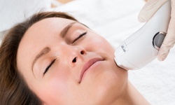 One or Two IPL Photofacial Treatments at Spa By Di Vine and Wellness Institute (Up to 73% Off)
