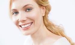 4, 6, 8, or 10 Porcelain Veneers at GF Dental in Rowlett (Up to 63% Off) 