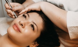 One or Two Microneedling Treatments with Optional Growth Factor at AP Laser (Up to 50% Off)
