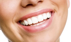 LED and Infrared Teeth Whitening w/ Optional Airbrush Tan at Sunless Beauty - Organic Spray Tan (Up to 52% Off)