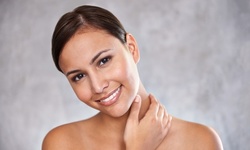 One IPL Photofacial Treatment for Face or for Face, Neck, and Chest at Althea Medspa (Up to 71% Off)