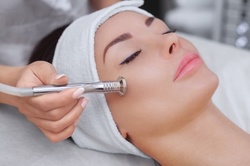 One or Three Microdermabrasion Treatments at Moselle Beauty (Up to 48% Off) 