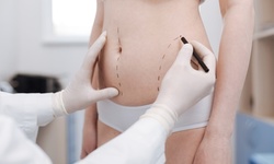Chin Contouring or Body Sculpting at 247 Natural Wellness Center (Up to 78% Off). Three Options Available.