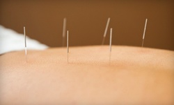$45 for an Acupuncture Session with Consultation at North Nassau Acupuncture LLC ($90 Value)
