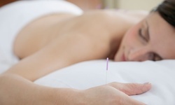 One Acupuncture Session at Great Lakes Health and Wellness (Up to 64% Off). Three Options Available.