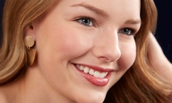 Up to 75% Off on Teeth Whitening - In-Office - Branded (Beyond, Power) at White Obsessions