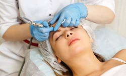One or Two Diamond Microdermabrasions at Fit & Healthy by HMMC (Up to 69% Off)