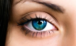 50% Off Upper-Eyelid-Reduction Procedure for Both Eyes at Younger Image Plastic Surgery Center