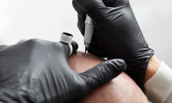 $399.20 for One Scalp-Micropigmentation Session with Consultation at Aesthetic Solutions NY ($1,500 Value)