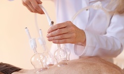 One or Three 30-Minute Cupping Sessions at Time For You Massage Therapy (Up to 40% Off)