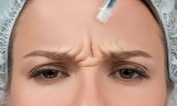 20 or 40 Units of Botox at Newmedica Aesthetic Institute - Garden Grove (Up to 49% Off)