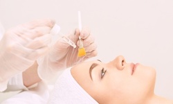 One or Three PCA Chemical Peels at Esthetics by Shawna (Up to 40% Off)