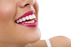 Up to 67% Off on Teeth Whitening - In-Office - Branded (Zoom, Brite Smile) at Angelinas Heavenly hands