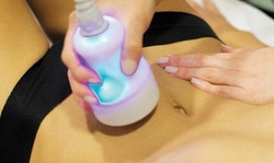 Up to 41% Off on Cryotherapy at She Arted llc