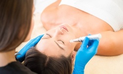 PRP Facial with Skin Bightening, Microneedling, or Both at Revitalize Life Center (Up to 80% Off)