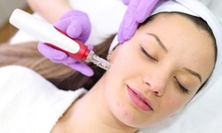 Up to 64% Off on Micro-Needling at Cara Lash Care & Waxing