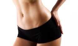 One, Three, or Five Radio Frequency Skin-Tightening Treatments at Body Kasha (Up to 83% Off)