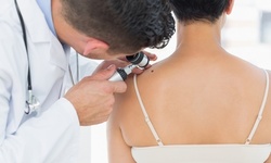 Up to 68% Off on Mole / Growth Removal at Nu U Medspa and Laser Center