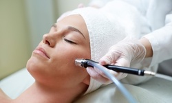 One or Two Microdermabrasions at Columbia Laser and Aesthetics Center (Up to 54% Off)