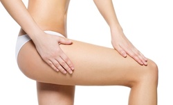 One or Three Cellulite Reduction Treatments at Icon Wellness (Up to 87% Off)