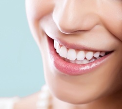Up to 49% Off on Teeth Whitening - In-Office - Non-Branded at Bora Beauty LLC