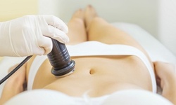 One, Three, or Six Cavi-Lipo Treatments at Healthway Medical, P.C. (Up to 85% Off)