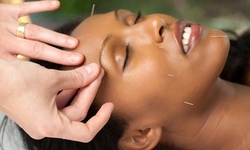 One, Three, or Five Acupuncture, Cupping, or Other Treatments at Acupuncture Center of Baltimore (Up to 75% Off)