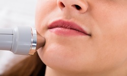 $66.75 for One IPL Photofacial Treatment with Visia Skin Analysis at SkinSpaMed ($650 Value) 