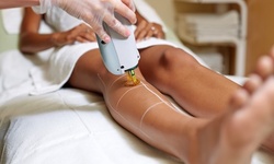 Six Laser Hair-Removal Sessions at Eye Candy Rejuvenation Center (Up to 68% Off). Three Options Available.