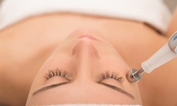 One or Three Microdermabrasion Treatments at Farkas Plastic Surgery (Up to 78% Off)