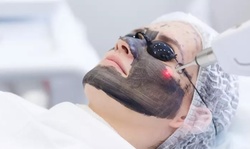 1 or 2 Laser Collagen Treatments for the Forehead, Eyes, and Neck at Hilda Demirjian Laser & Spa (Up to 93% Off)