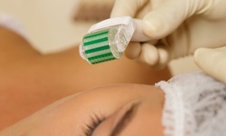 One or Two Microneedling Sessions with Optional BB Glow at J Lash & Brow Bar (Up to 69% Off)