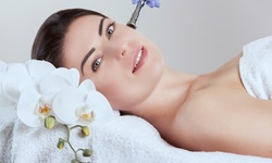 Diamond Microdermabrasion Treatments at Montclair Rejuvenation Center (Up to 60% Off). Two Options Available.