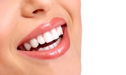 Dental Exam, X-Rays, Cleaning, and an Optional 6-Month Follow-Up Cleaning at Advance Dental Care (Up to 62% Off)